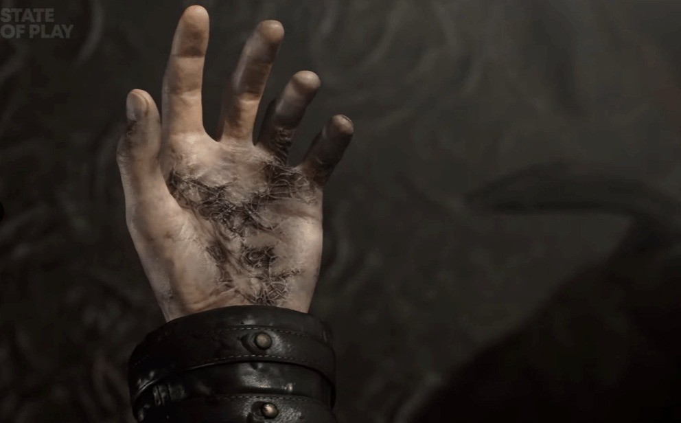 里昂危险了？《生化危机9》新细节：新病毒不变异只致死