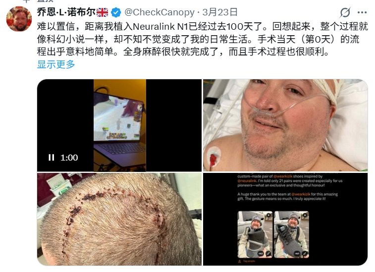 英国退伍军人使用脑机接口玩《魔兽世界》